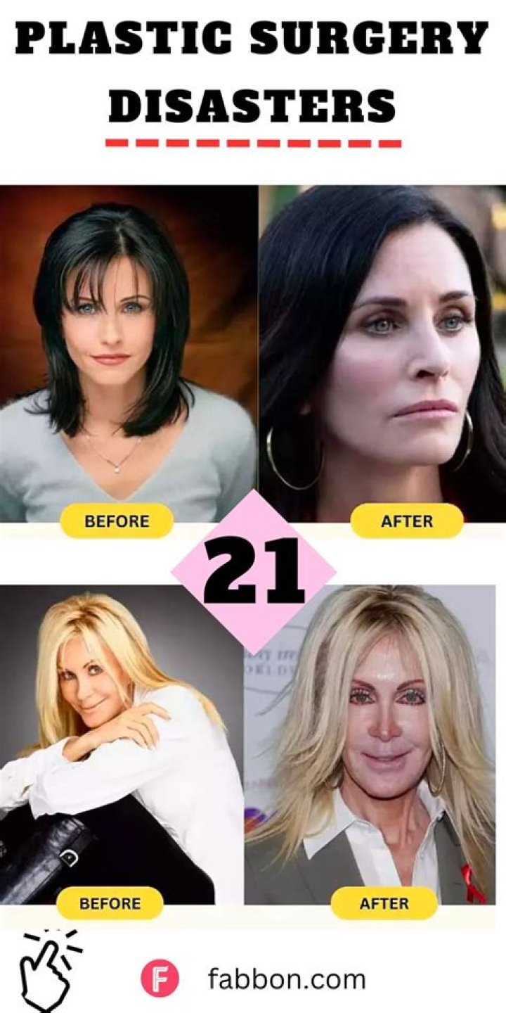 A Botched-Up Surprise: Uncovering Justin's Plastic Surgery Disasters