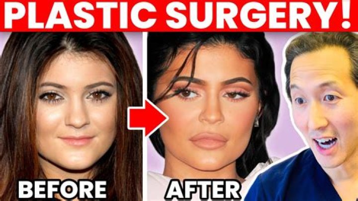 A Deep Dive Into Her Plastic Surgery Journey