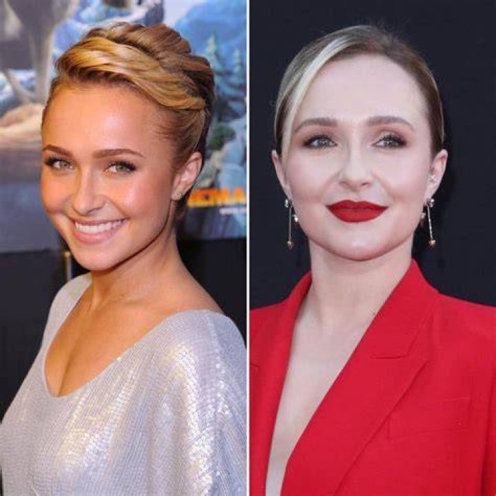 All Your Questions Answered: Hayden Panettiere's Plastic Surgery Journey
