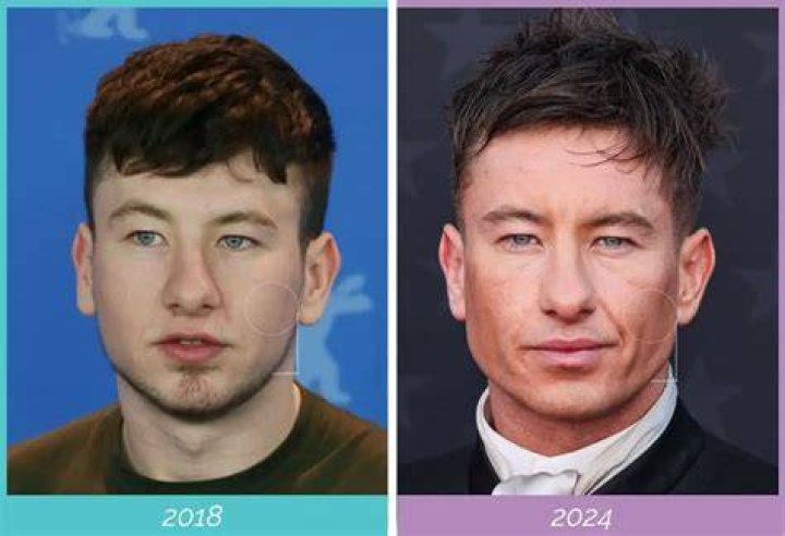 Blonde Ambition: Barry Keoghan's Stunning Transformation