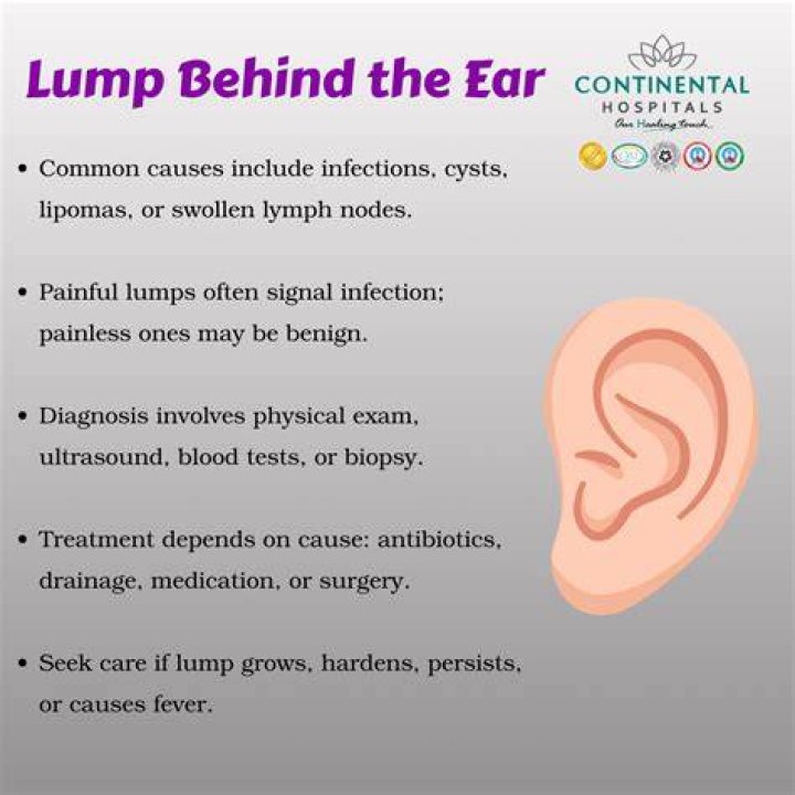 Cillian Murphy's Mysterious Lump Behind Ear: Explained
