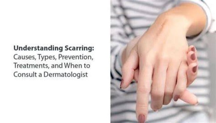 Discover The Ultimate Guide To Seal Scarring: Causes, Prevention, And Treatment