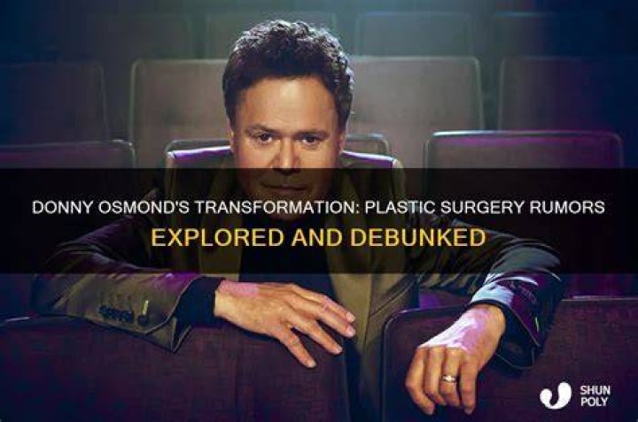 Donny Osmond's Plastic Surgery Journey Explored