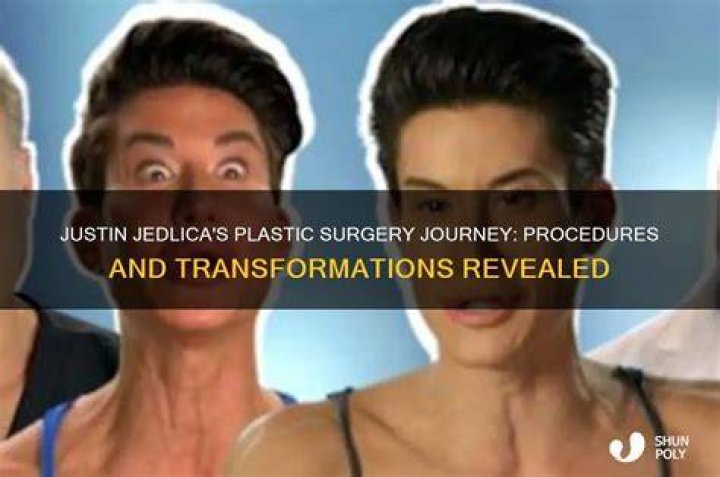 Epic Plastic Surgery Transformation Of Justin Jedlica