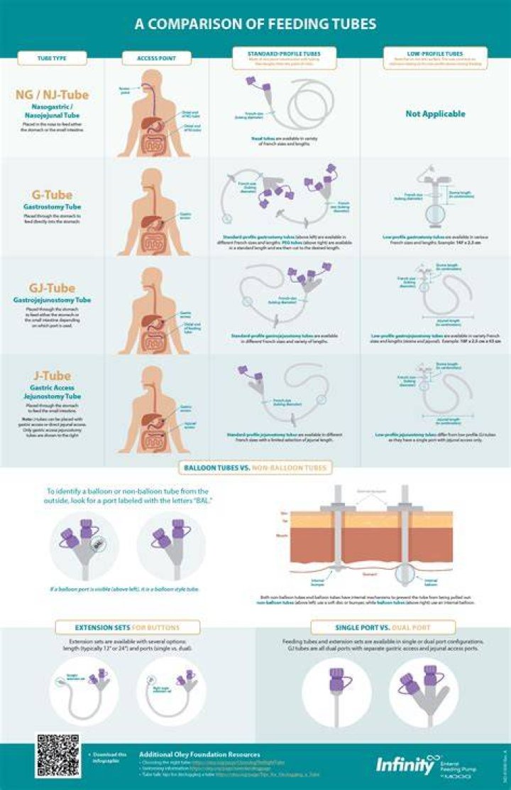 Essential Guide To Dobhoff Tube Placement: Procedure, Benefits, And Risks