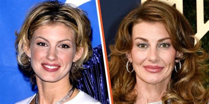 Faith Hill Surgery: An In-Depth Look At The Surgery She Underwent