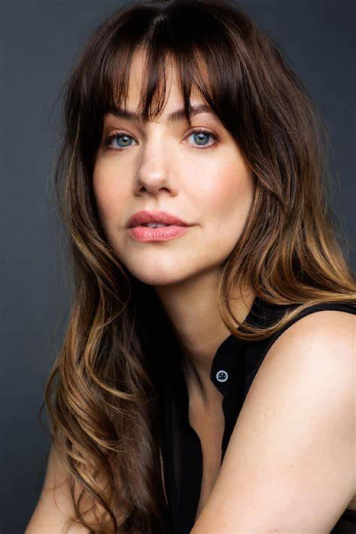 Famous Actress Julie Gonzalo Shows Off Eye-Catching Scar