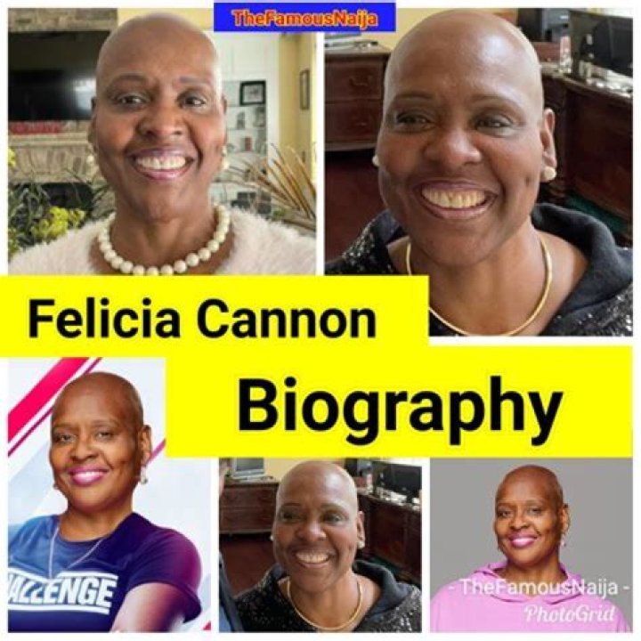 Felicia Of Big Brother Opens Up About Hair Loss Journey