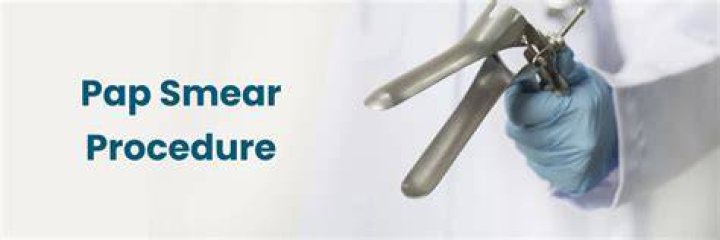 Find The Essential ICD-10 Code For Pap Smears: A Comprehensive Guide