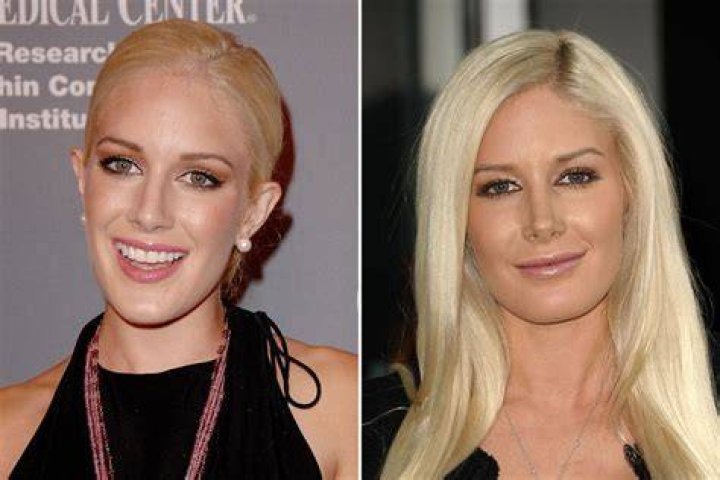 Heidi Montag's Pre-Surgery Transformation: An Unrecognizable Beauty