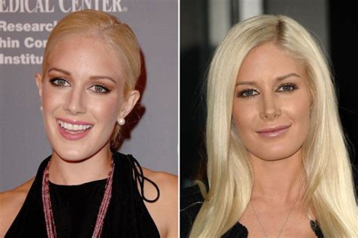 Heidi Montag's Stunning Transformation: Before And After Surgery