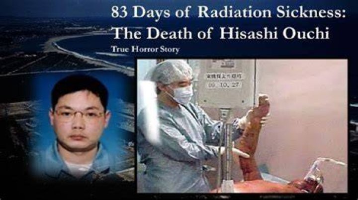 Hisashi Ouchi's Uncensored Photos: A Deeper Truth Revealed