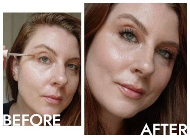 Incredible "Before And After" Transformation Of Heidi: A Journey Of Beauty And Inspiration