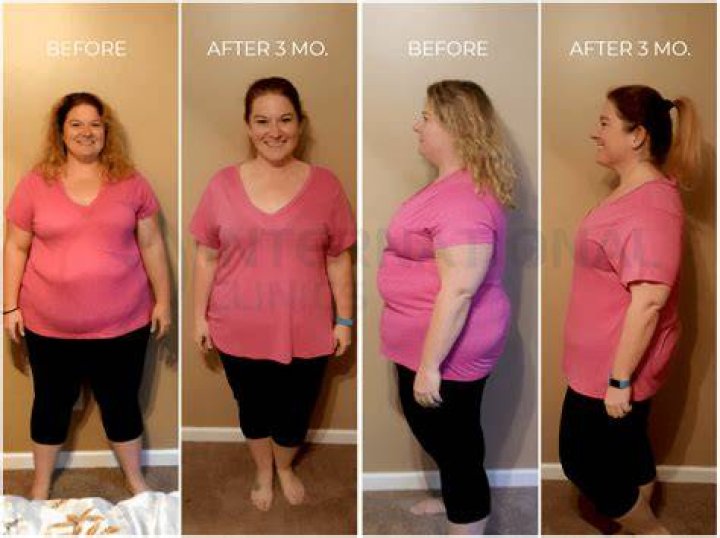 Incredible Transformation: Heidi Montag's Before And After Journey