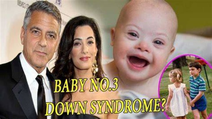 Is George Clooney's Son Suffering From Down Syndrome? Uncovering The Truth