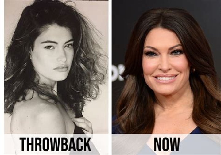 Kimberly Guilfoyle's Transformation: Before And After Insights