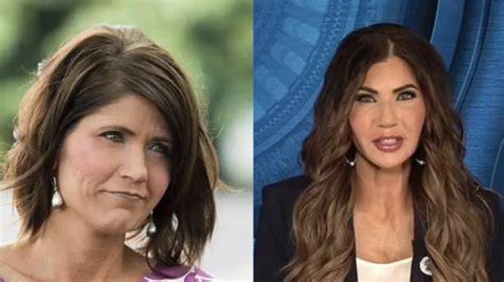 Marlo Thimas: The Truth About Her Plastic Surgery Revealed