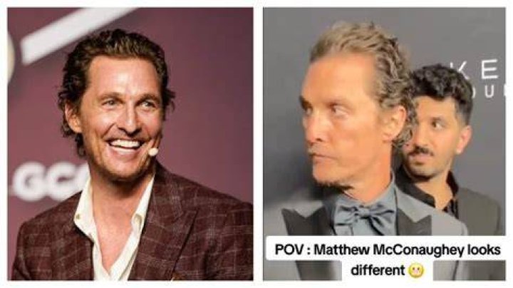 Matthew McConaughey's Guide To Plastic Surgery: Unlocking Youthful Beauty