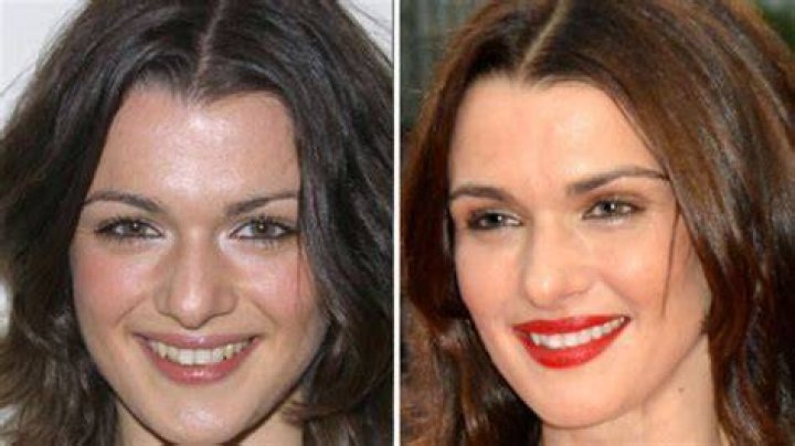 Rachel Weisz Plastic Surgery: Did She Or Didn't She?