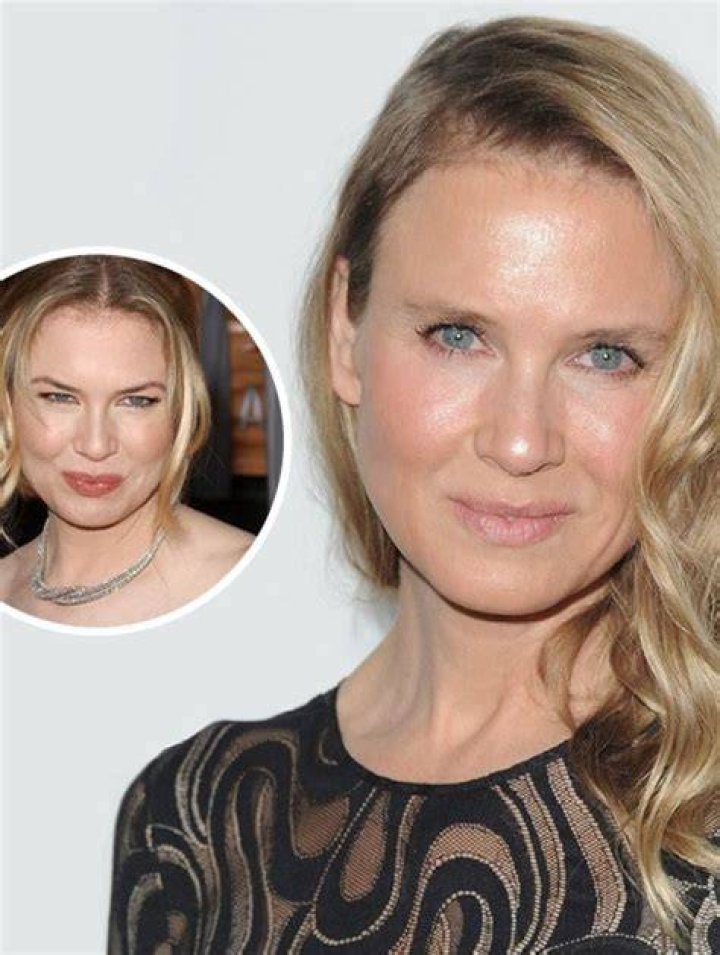 Rene Zellweger's Youthful Transformations: A Journey Through The Years