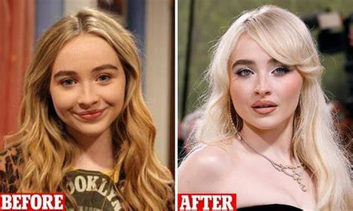 Sabrina Carpenter's Lip Injections: The Truth Revealed