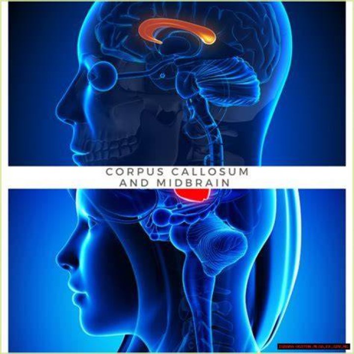 The Essential Role Of The Corpus Callosum: Connecting The Brain