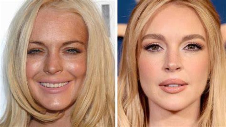 The Impact Of Arrested Development On Lindsay's Transformation