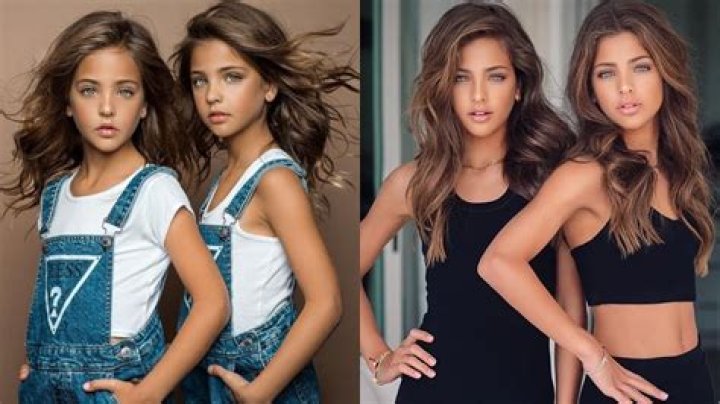 The Most Beautiful Twins In History