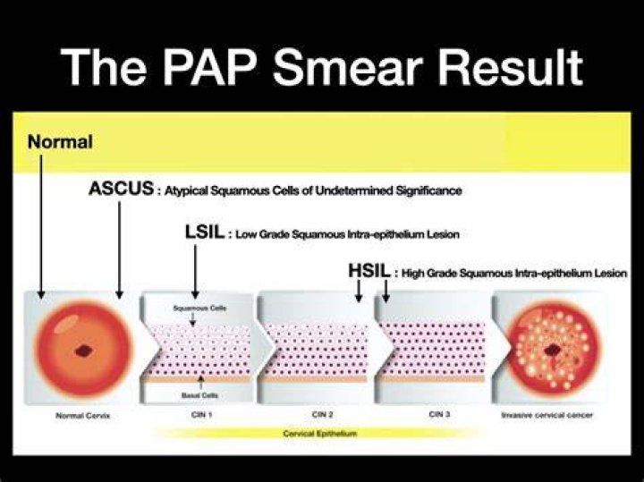 The Quick Guide To ICD-10 Codes For Abnormal Pap Smears