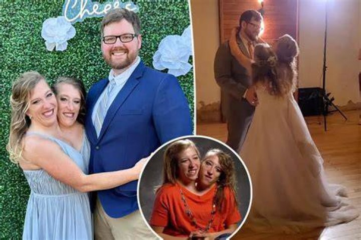 The Tragic Tale Of The Hensel Conjoined Twins: Abby And Brittany's Family's Heartbreak