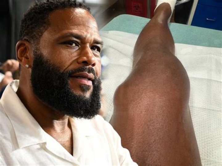 The Truth About: Does Anthony Anderson Have A Twin Brother?