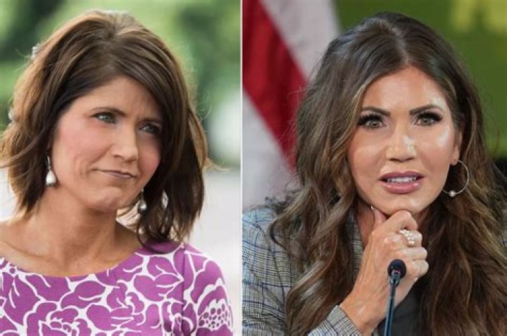 The Truth About Kirstie Noem's Plastic Surgery Rumors