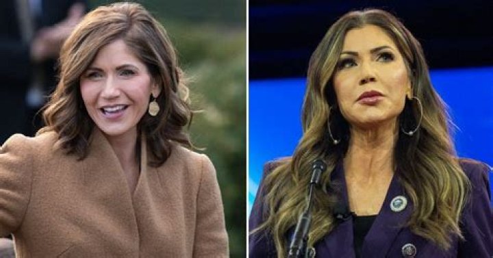 The Truth About Kristi Noem's Alleged Facelift Procedure