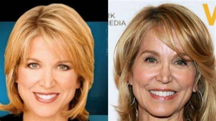 The Truth About Paula Zahn's Plastic Surgery: Before And After