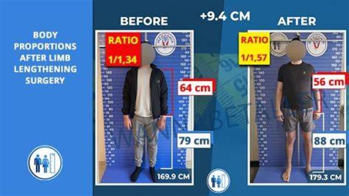 The Ultimate Guide To Achieving The Perfect Torso To Leg Ratio