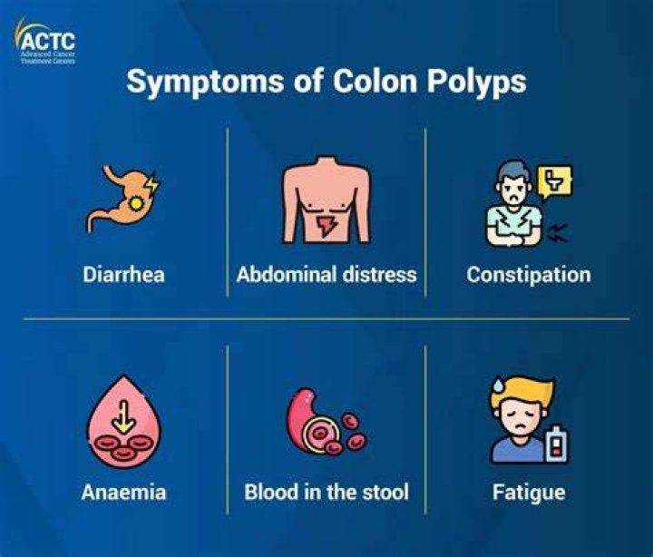 The Ultimate Guide To Colon Nodules Vs Polyps: Everything You Need To Know
