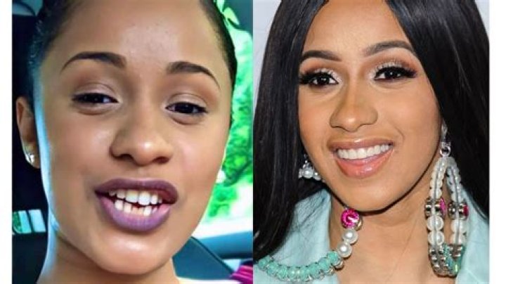 Uncover The Secrets Behind Cardi B's Iconic Teeth