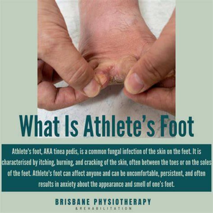 Uncover The Truth: Can A Hot Tub Give You Athlete's Foot?