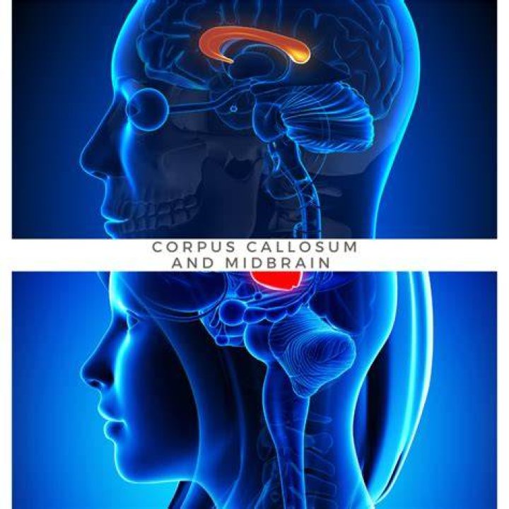 Understand The Vital Role Of The Corpus Callosum In Your Brain's Function