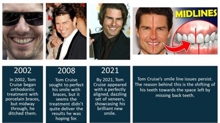 Unmasking Tom Cruise's Notorious Teeth: A Candid Examination