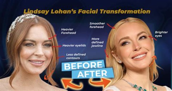 Unveiling Lindsay Lohan's Nose Journey: Insights And Transformations