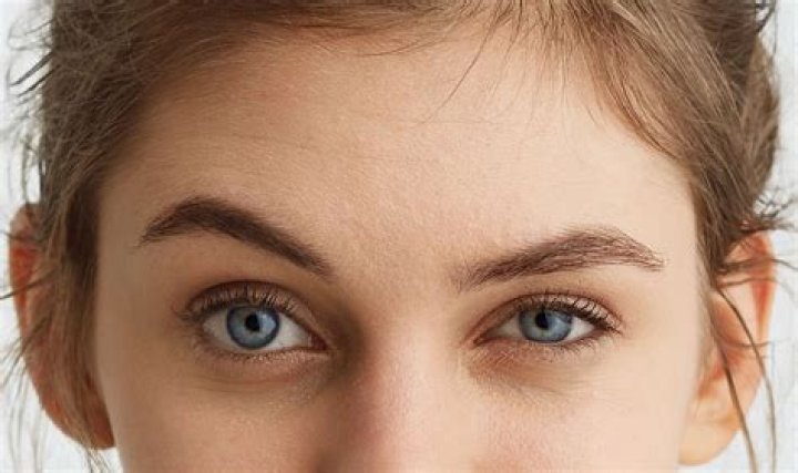 Unveiling The Enigmatic Blonde Actress With Scar Between Eyebrows