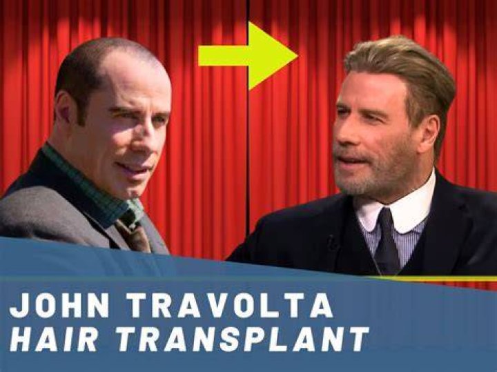 Unveiling The Reasons: Why Did John Travolta Shave His Head?