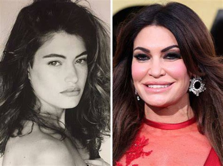 Unveiling The Transformation: Kimberly Guilfoyle Before And After Plastic Surgery