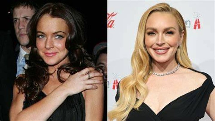 Unveiling The Truth About "Lindsey Lohan Botox": Discoveries And Insights