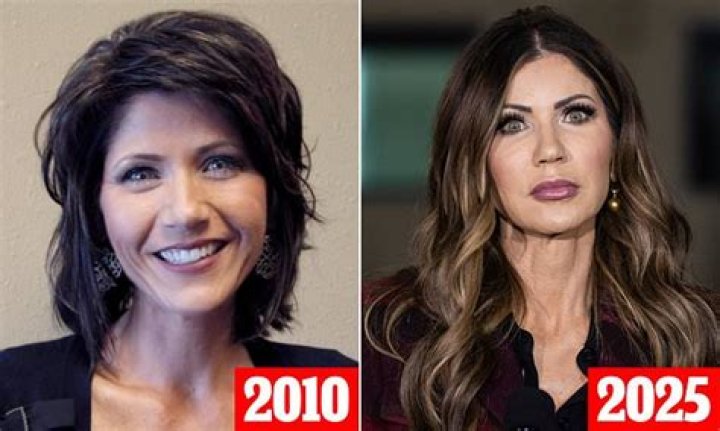 Unveiling The Truth Behind Kristi Noem's Cosmetic Enhancements