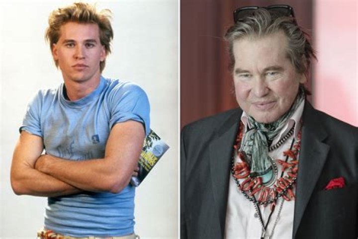 "Val Kilmer's Transformation: Battling Weight Gain"