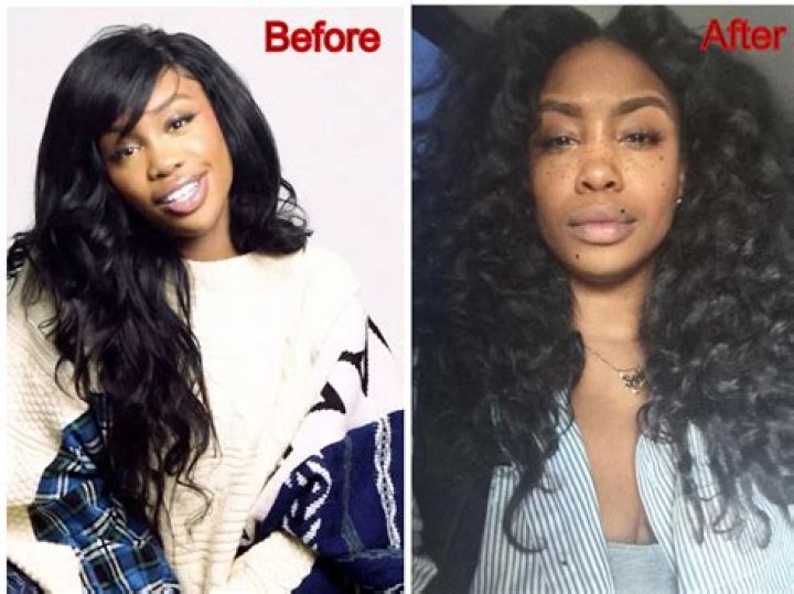 Wendy Williams' Plastic Surgery Journey: Uncovering Surprising Truths